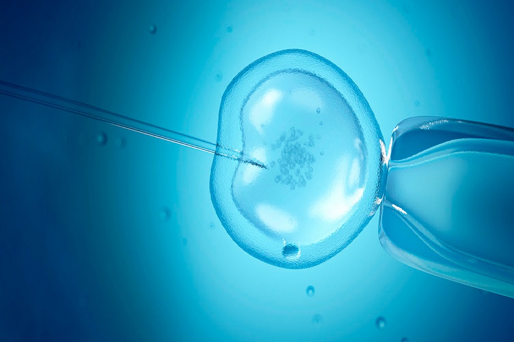 ivf-with-icsis iaso ivf center cyprus