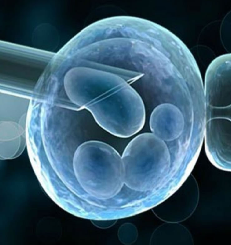 Preimplantation Genetic Testing (PGT) and IVF