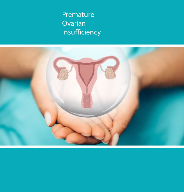 premature ovarian insufficiency